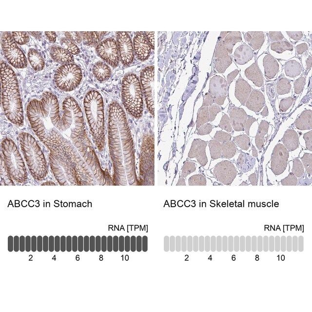 Anti-ABCC3 antibody produced in rabbit