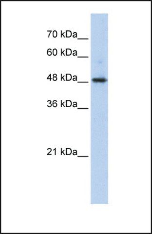 Anti-ABHD2 antibody produced in rabbit