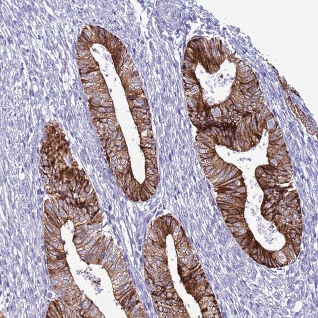 Anti-ABHD17B antibody produced in rabbit