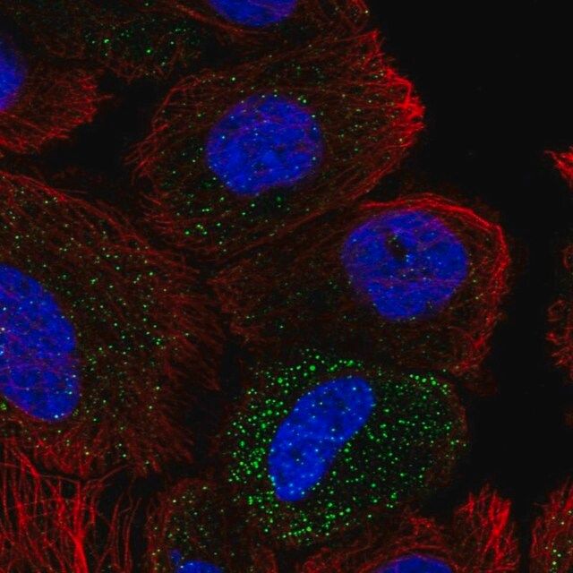 Anti-ABHD14A antibody produced in rabbit