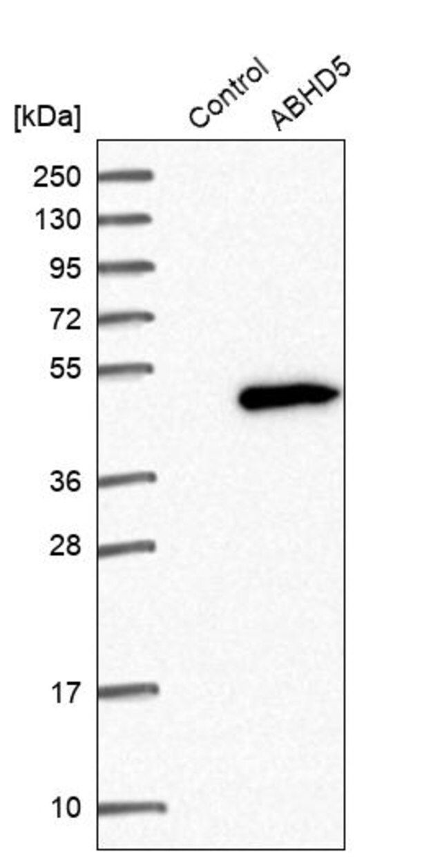 Anti-ABHD5 antibody produced in rabbit