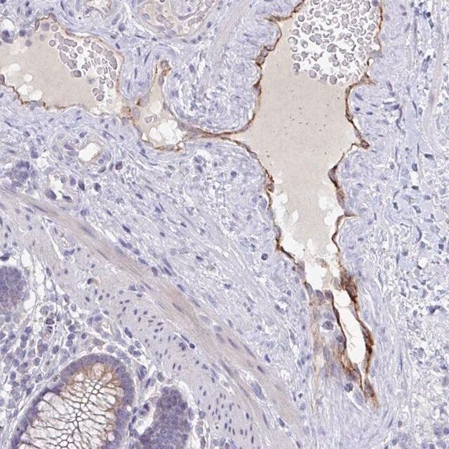 Anti-ABHD16A antibody produced in rabbit