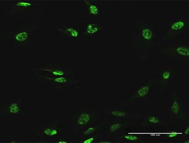 Anti-ABHD11 antibody produced in mouse