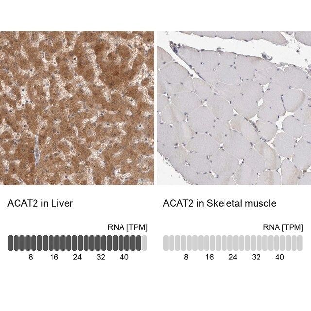 Anti-ACAT2 antibody produced in rabbit