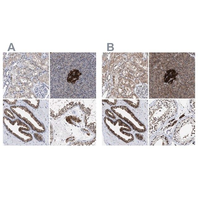 Anti-ACLY antibody produced in rabbit