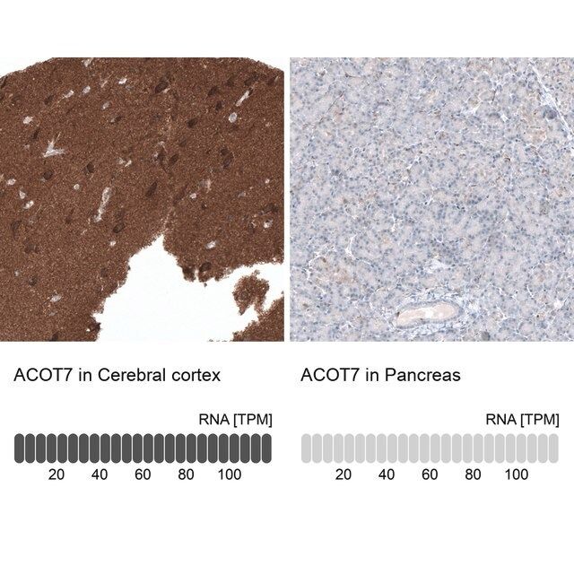 Anti-ACOT7 antibody produced in rabbit