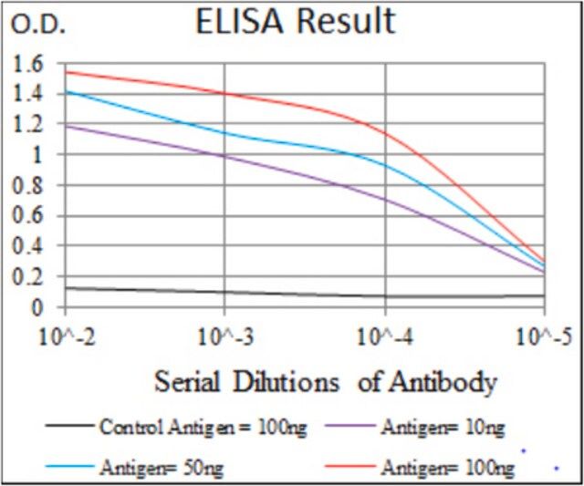 Anti-ACLY, clone 5F8D11 Antibody