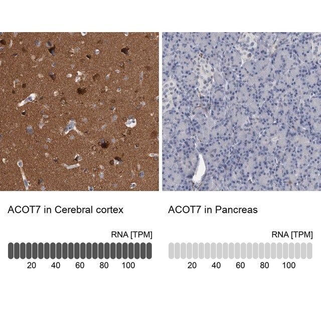 Anti-ACOT7 antibody produced in rabbit