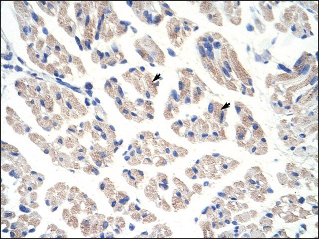 Anti-ACO1 antibody produced in rabbit