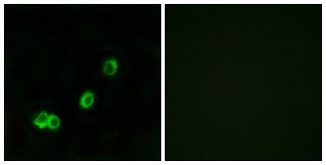 Anti-ACOT1 antibody produced in rabbit