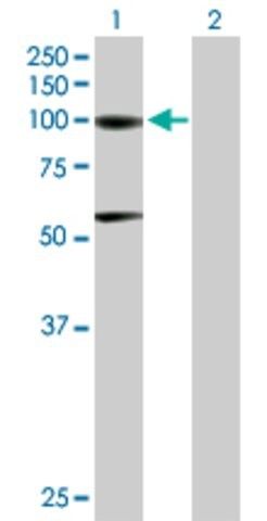 Anti-ACO1 antibody produced in mouse