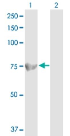 Anti-ACOX1 antibody produced in rabbit