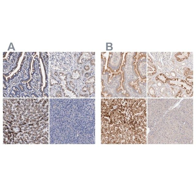 Anti-ACOX1 antibody produced in rabbit