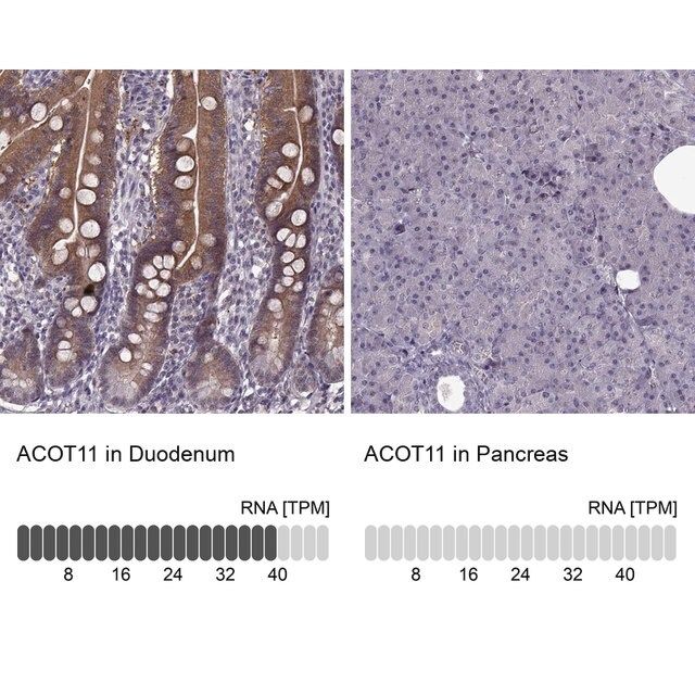 Anti-ACOT11 antibody produced in rabbit