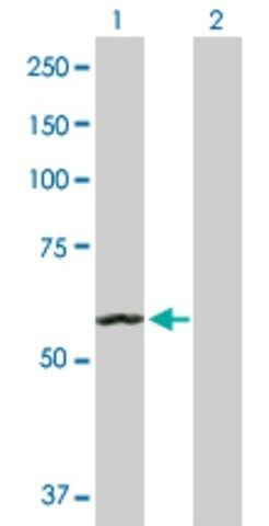 Anti-ACO2 antibody produced in rabbit