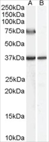 Anti-ACOX2 (AB2) antibody produced in goat