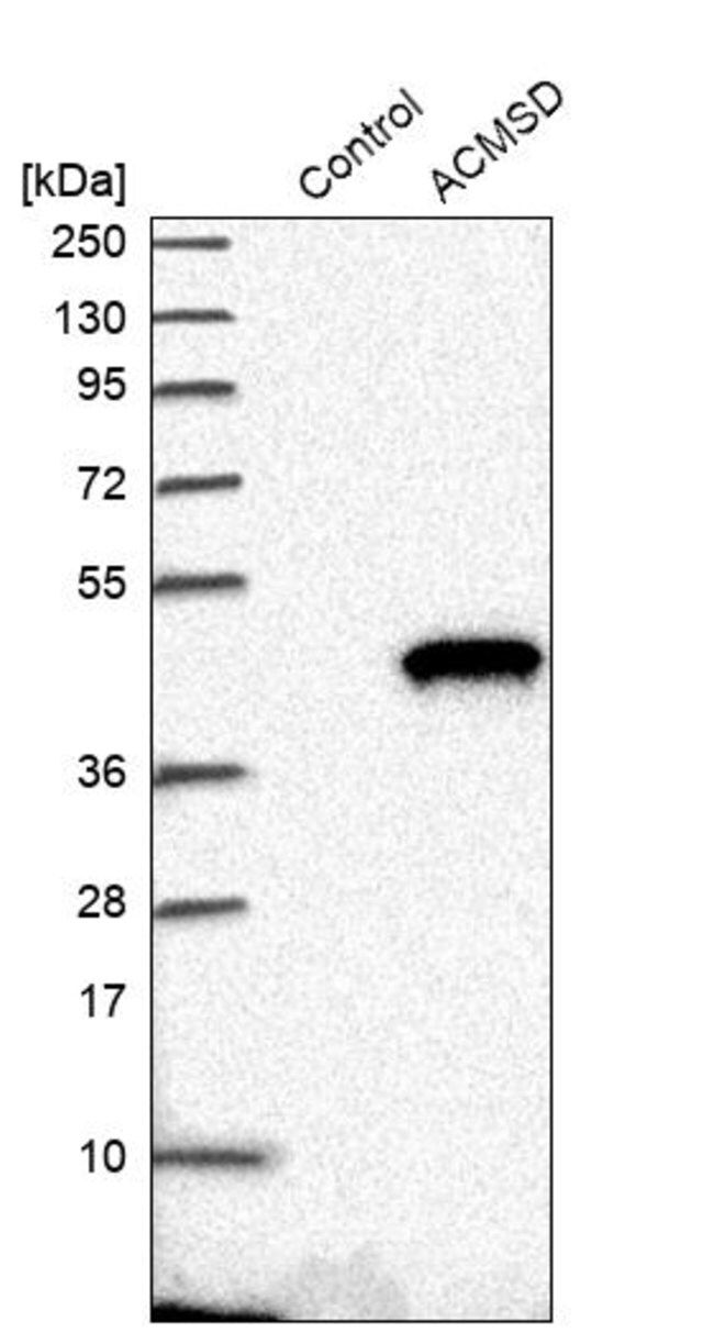 Anti-ACMSD antibody produced in rabbit