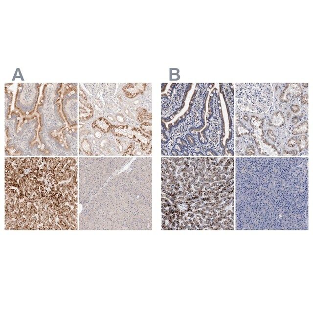 Anti-ACOX1 antibody produced in rabbit