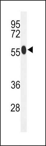 ANTI-ACSM1 (N-TERM) antibody produced in rabbit