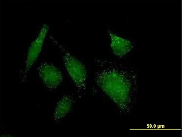 Anti-ACOT8 antibody produced in mouse