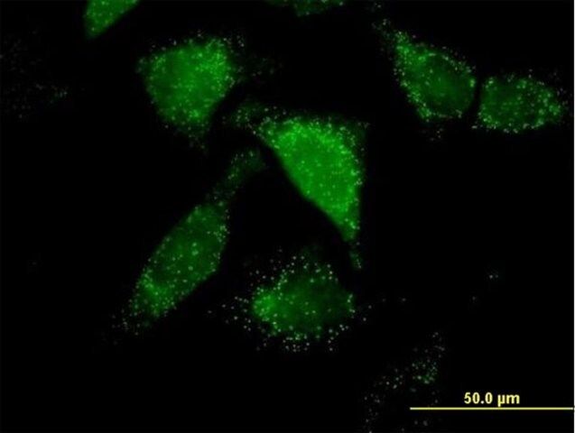 Anti-ACOX1 antibody produced in mouse