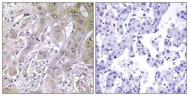 Anti-ACOT12 antibody produced in rabbit