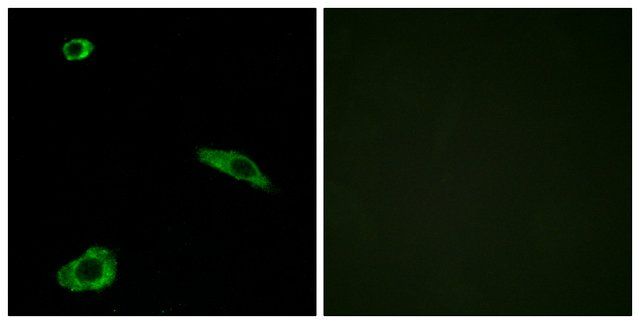 Anti-ACTHR antibody produced in rabbit