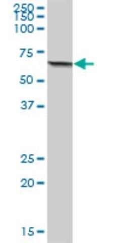 Anti-ACSM3 antibody produced in mouse