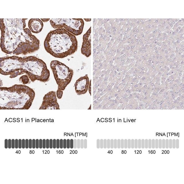 Anti-ACSS1 antibody produced in rabbit