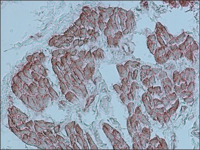 Anti-Actin (-Sarcomeric) antibody, Mouse monoclonal