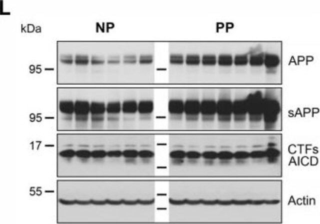 Anti-Actin Antibody, smooth muscle  & actin, clone CGA7