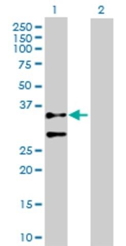 Anti-ACTG2 antibody produced in rabbit