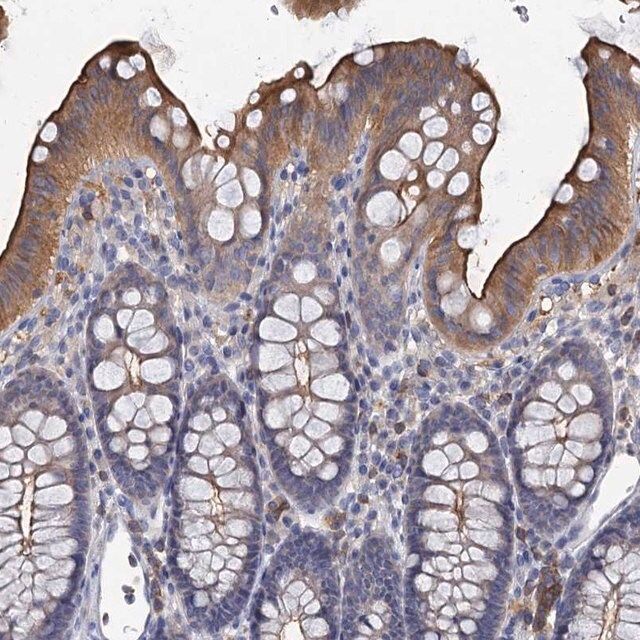 Anti-ACSM3 antibody produced in rabbit