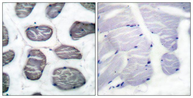 Anti-ACTIN--1 antibody produced in rabbit