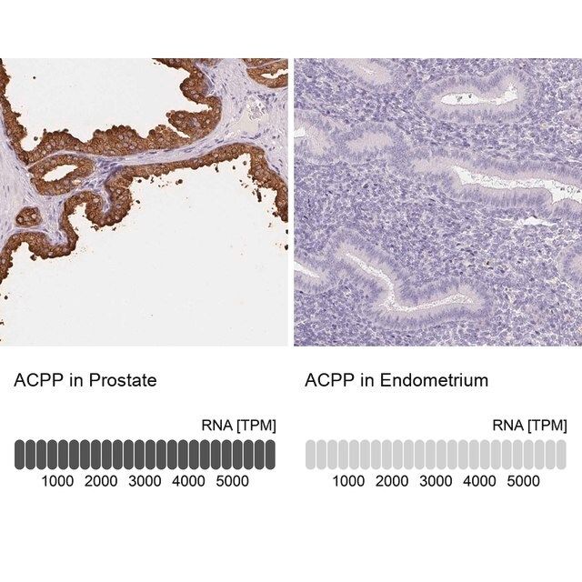 Anti-ACPP antibody produced in rabbit