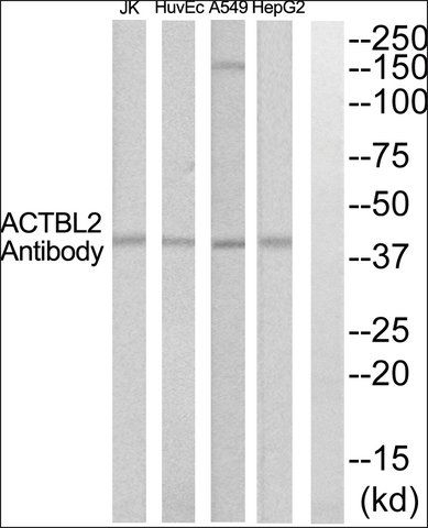 Anti-ACTBL2 antibody produced in rabbit