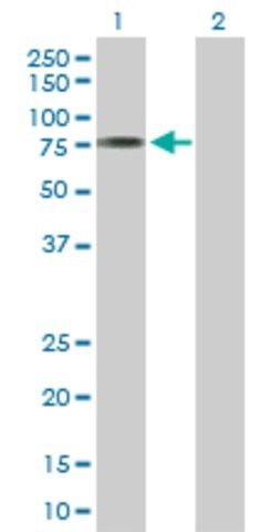 Anti-ACSM3 antibody produced in rabbit