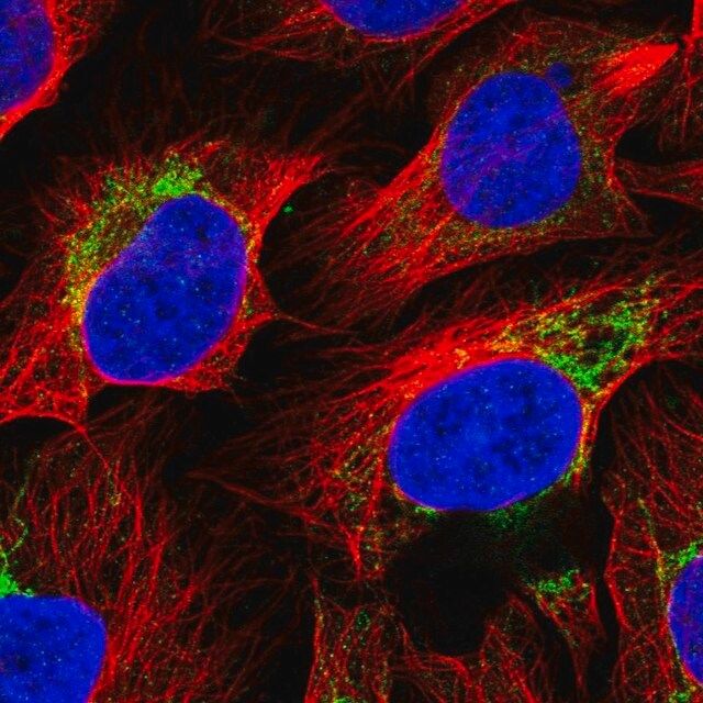 Anti-ACSS3 antibody produced in rabbit