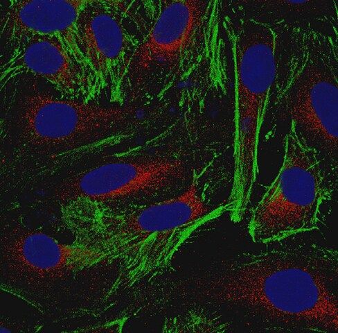 Anti-Actin Antibody, clone 2G2