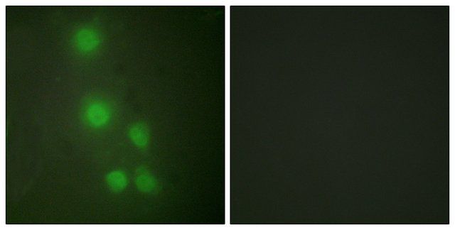 Anti-ACTL6A antibody produced in rabbit