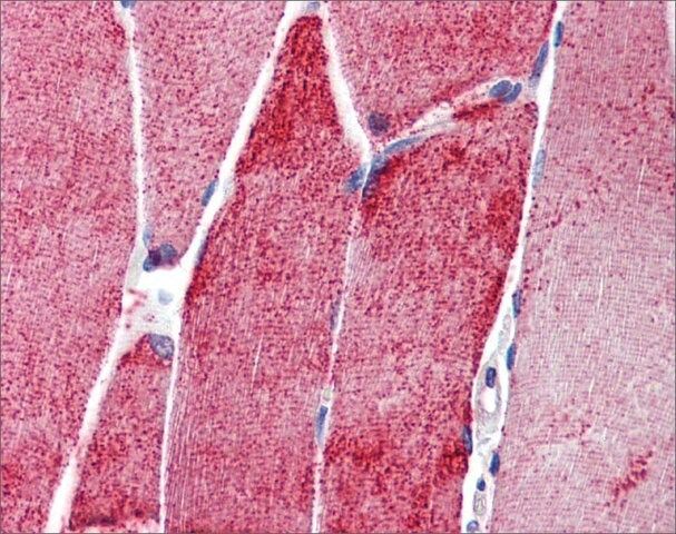 Anti-ACTN3 antibody produced in rabbit