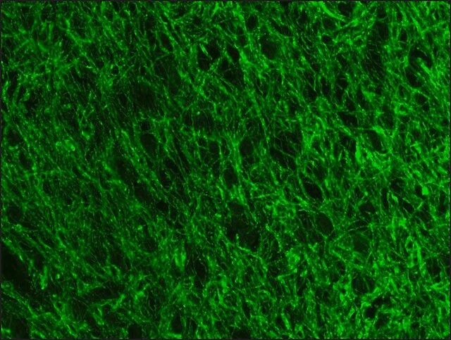 Anti- Neurofilament 200-FITC antibody, Mouse monoclonal