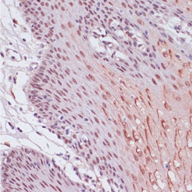 Anti- KDM1 antibody produced in rabbit