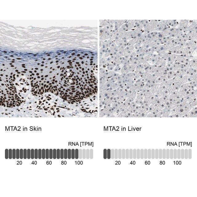 Anti-MTA2 antibody produced in rabbit