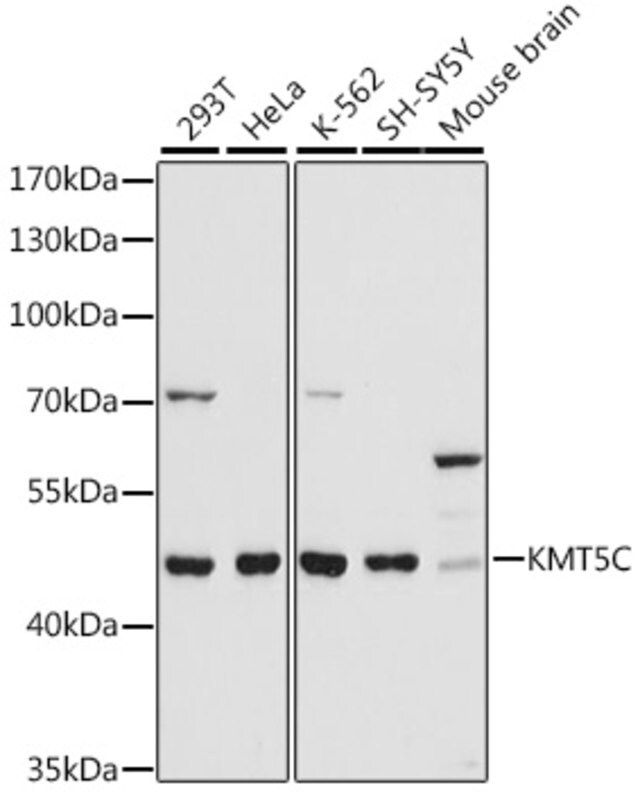 Anti- KMT5C antibody produced in rabbit