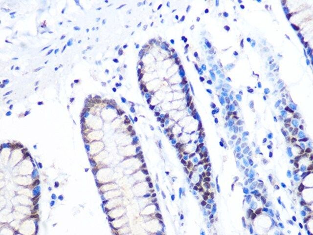 Anti- MTA2 antibody produced in rabbit