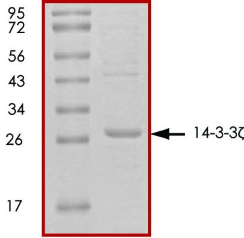 14-3-3 , untagged human