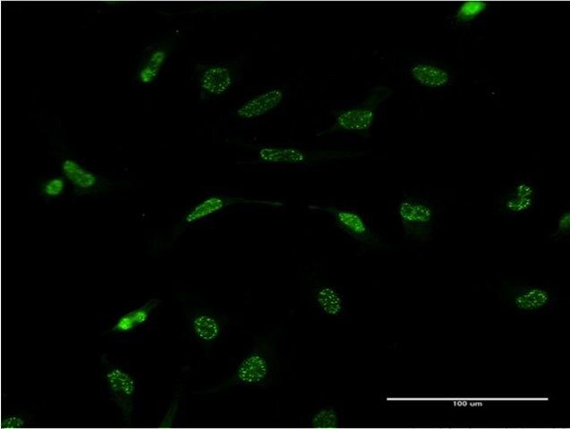 Monoclonal Anti-WT1 antibody produced in mouse