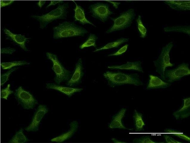 Monoclonal Anti-YWHAG antibody produced in mouse