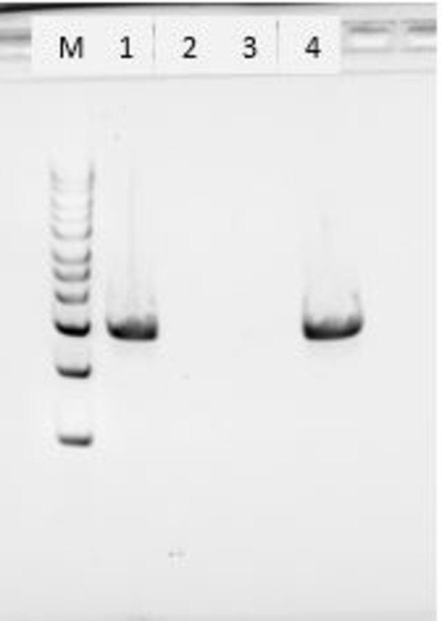 Proteinase K from Tritirachium album